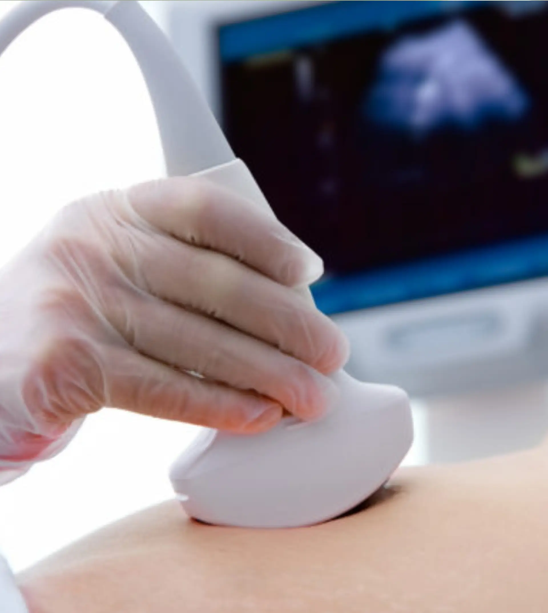 ultrasound