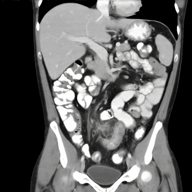 abdoman