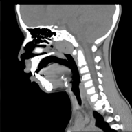 adnoid