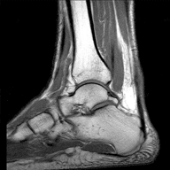 ankle