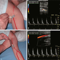 articular