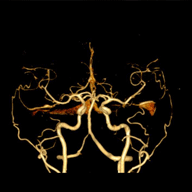 brain