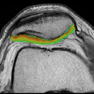 cartigram