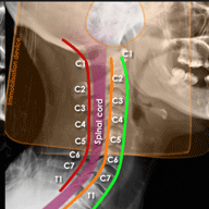 cervical_x