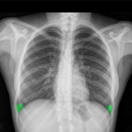 chest
