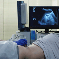 kidney_usg
