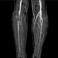 limb