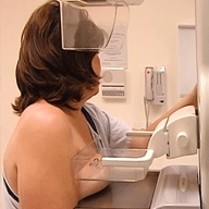 mamogram