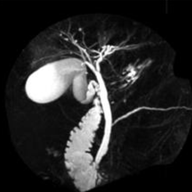 mrcp