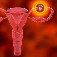 pregnancy