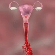 vaginal_bleeding